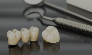 Visit Boca Mission Bay Dentistry, Dr. Sierra, DMD for Crowns and Bridges