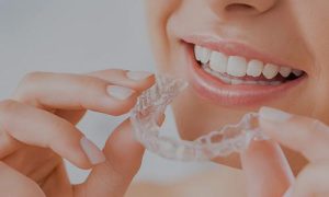 Visit Boca Mission Bay Dentistry, Dr. Sierra, DMD for Invisalign